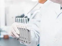 2025中國貧血日丨貧血診斷標(biāo)準(zhǔn)的本土化差異：在科學(xué)問題與醫(yī)療資源間尋找平衡